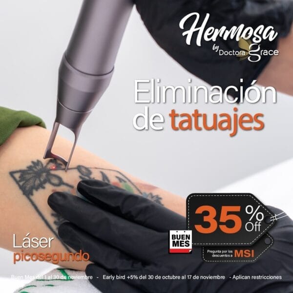 Eliminación de Tatuajes