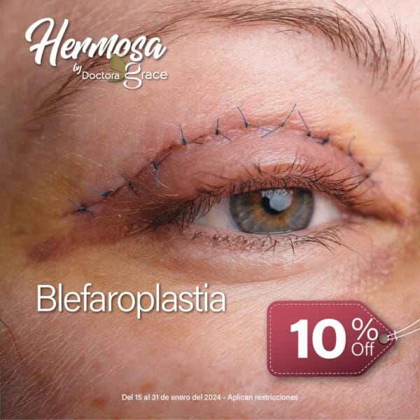 Blefaroplastia