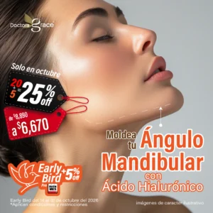 Relleno de Ácido Hialurónico en Ángulo Mandibular