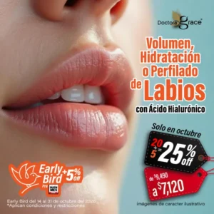 Relleno de Ácido Hialurónico en Labios
