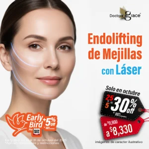 Endolifting de Mejillas con Láser