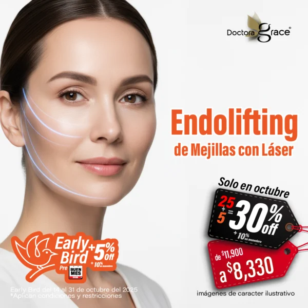 Endolifting de Mejillas con Láser
