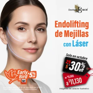 Endolifting de Mejillas con Láser