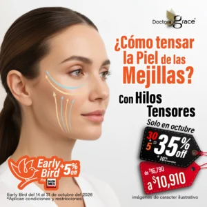 Hilos Tensores en Mejillas