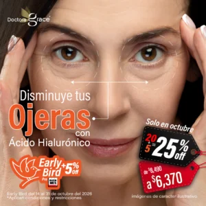 Relleno de Ácido Hialurónico en Ojeras